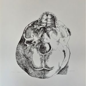 Plate XI [Skull, Superior] from Ars Anatomica